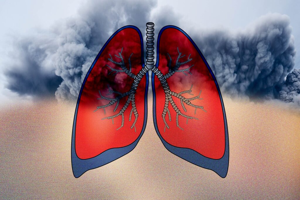 Smoking can cause lung damage.