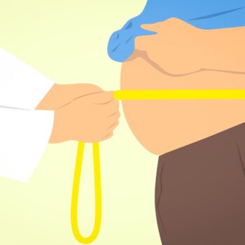 what is an apron belly and how to lose it